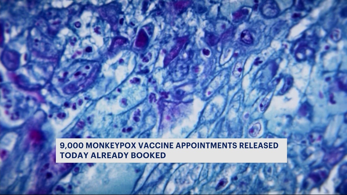 9,000 monkeypox vaccine appointments in New York City all booked within 2 hours